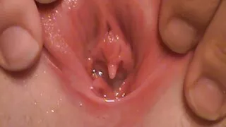 කළු ශිෂේණය ඍජු සේවය කිරීමට කැපවී සිටී